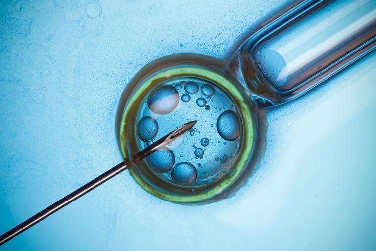 In vitro fertilization.