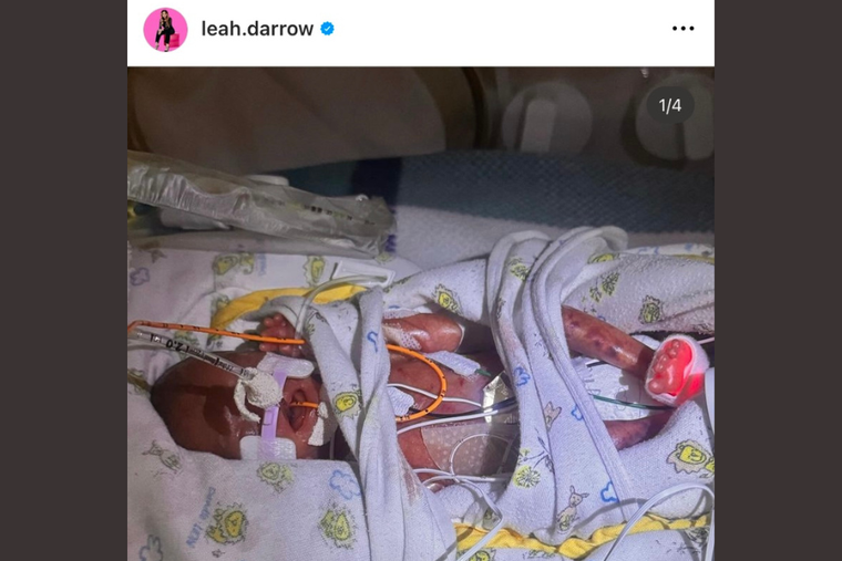 Leah Darrow’s husband, Ricky, posted about baby Sylvester Simeon Soldinie, who was born prematurely last night — weighing just 1 lb. 2 oz.