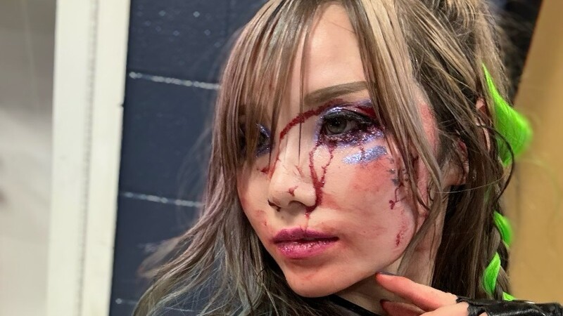Injury Update On Kairi Sane After 9/2 WWE RAW