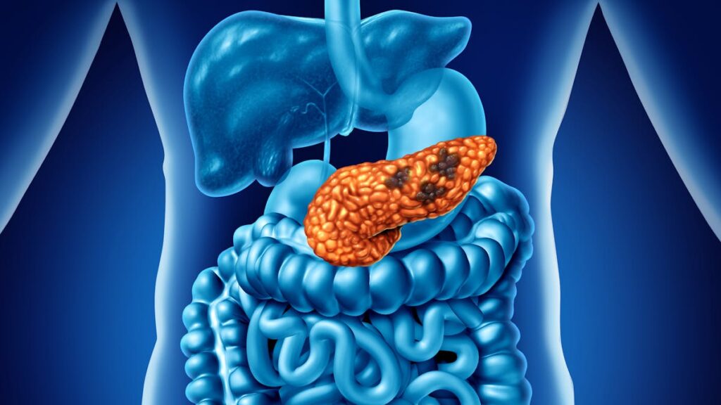 AI Detects Silent Killer Cancer 3 Years Before Diagnosis
